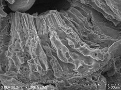 Proximal-tubule-conductive-staining2